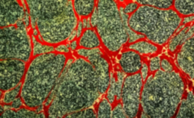 MarblePattern10