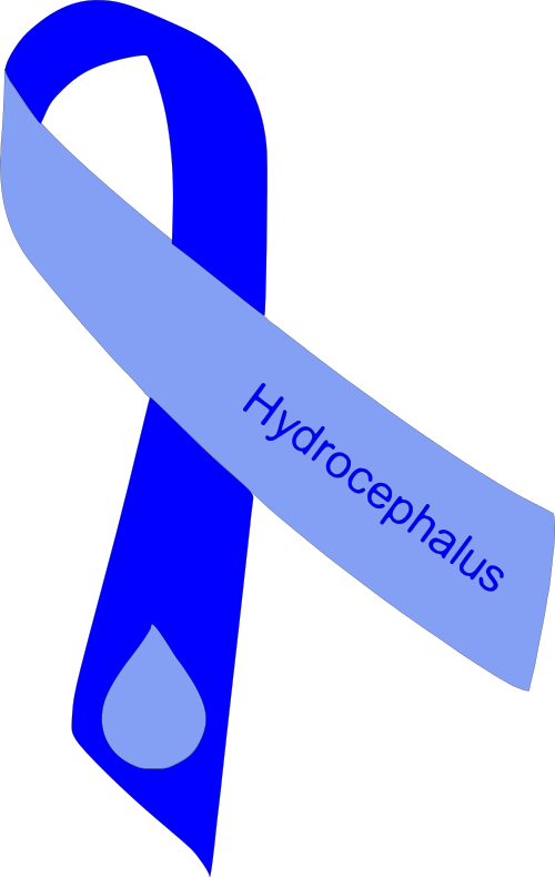 hydrocephalus ribbon