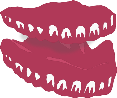 simpledentures