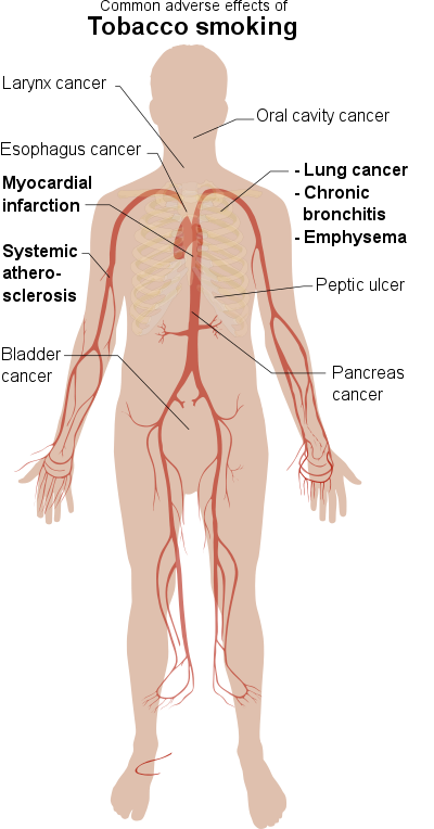 Adverse Effects Of Tobacco Smoking